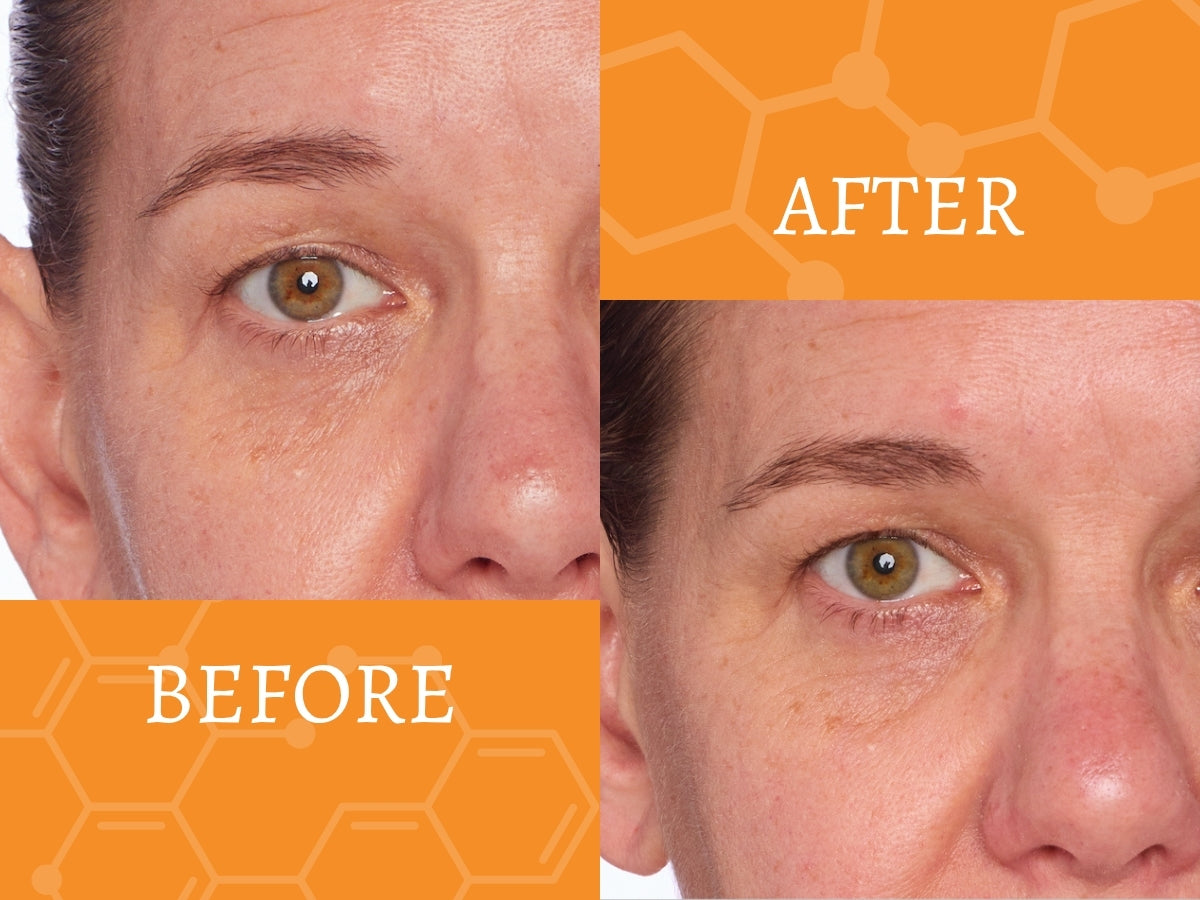 Before and after comparison of a man's eye area with an orange background when using Vitamin C Serum from New Level Skincare